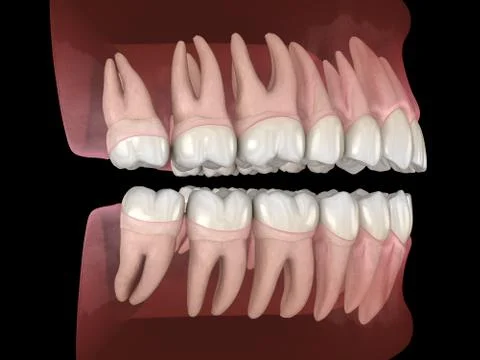 Morphology of mandibular and maxillary human gum and teeth. Medically accurat Illustrazione stock