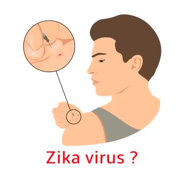 Mosquito bites man Stock Illustration