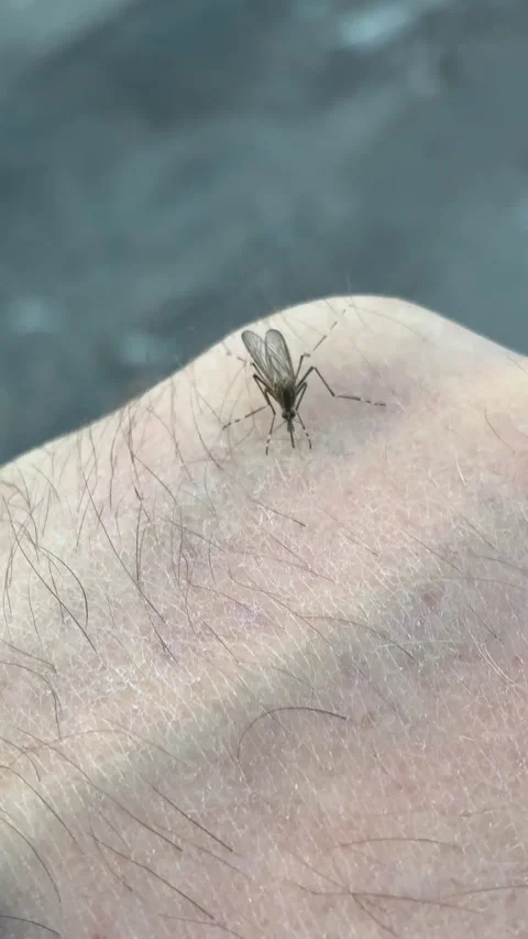 Mosquito Biting Human Skin Close-up Video stock 339021340