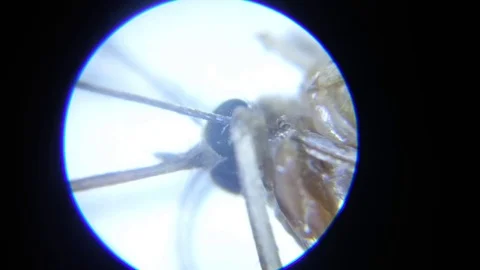 Mosquito Head Through Microscope Stock Footage 81755587