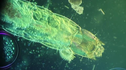 Mosquito larvae under biological microscope Stock Footage 62015771