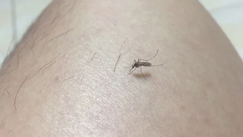 Mosquito on skin Video stock 79318461