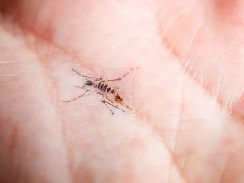 Mosquito smack Stock Photos