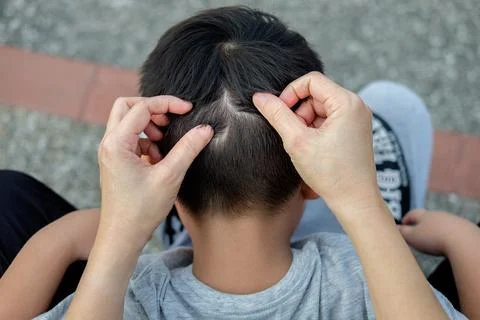 Mother is catching hair to find lice. Stock Photos