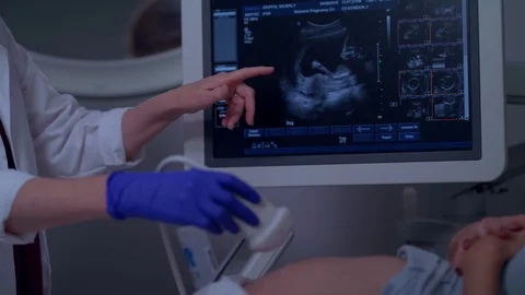 A MOTHER GETTING A SONOGRAM 스톡 동영상 108045191