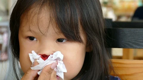Mother wipe her daughter's bleeding nose by paper Stock Footage 76568350