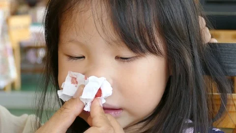 Mother wipe her daughter's bleeding nose by paper Stock Footage 76817335