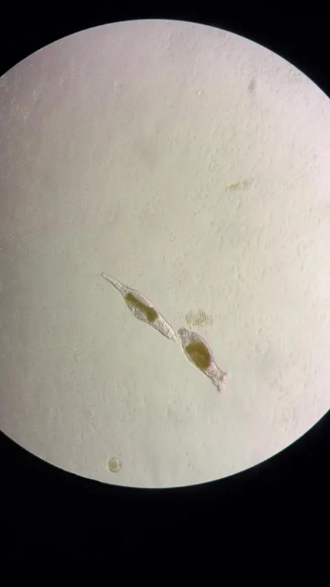 Motile Microorganisms Swimming Under a Microscope in a Chinese Laboratory Stock Footage 337915493