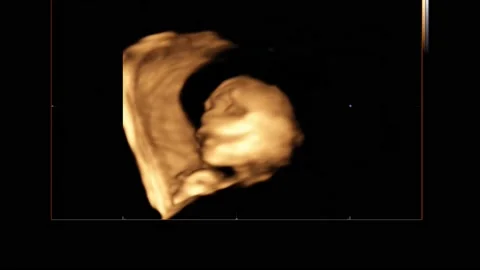 Womb Ultrasound Stock Footage ~ Royalty Free Stock Videos | Pond5