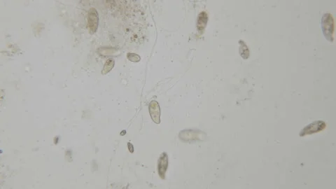 Motion of single-celled animals (infusoria) under microscope. Colony of cilia Stock Footage 98282983