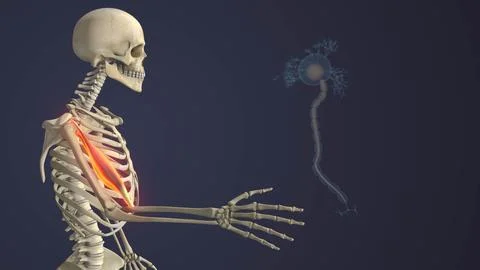 Motor Neuron Disease Causing Skeletal Muscle Weakness Stock Illustration