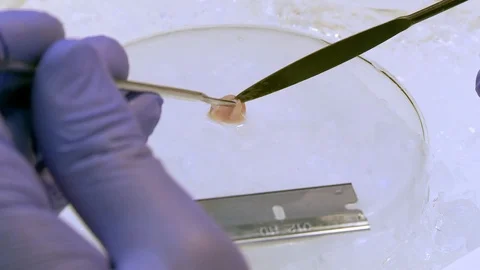 Mouse brain dissection on glass dish with scalpel close up Stock Footage 92622933