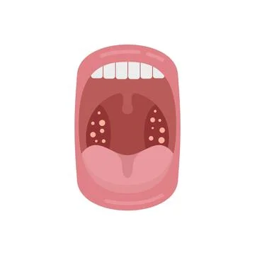 Mouth disease icon flat vector. Bacterial anatomy Stock Illustration