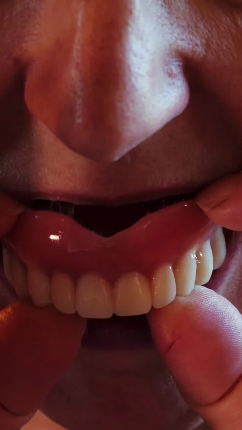 Mouth of elderly female pulls upper jaw out of mouth. Dentures. Vertical video Stock Footage 317097479