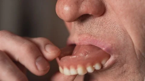 The mouth of an elderly man with false teeth. An older man pulls his jaw out Stock Footage 113142309