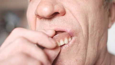 The mouth of an elderly man with false teeth. An older man pulls his upper jaw Stock Footage 113142364