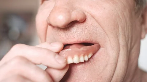 The mouth of an elderly man with false teeth. An older man inserts his upper jaw Stock Footage 113142430