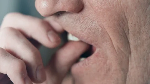 The mouth of an elderly man with false teeth. An older man pulls his upper jaw Stock Footage 113142450