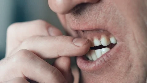 The mouth of an elderly man with false teeth. An older man inserts his upper jaw Stock Footage 113142531