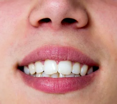 Mouth Stock Photos