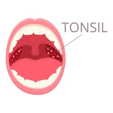 Mouth tonsillitis icon cartoon vector. Bacterial hygiene Stock Illustration