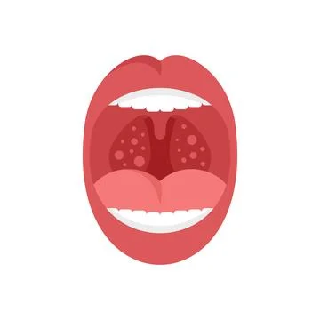 Mouth tonsillitis icon flat vector. Tonsil anatomy Stock Illustration