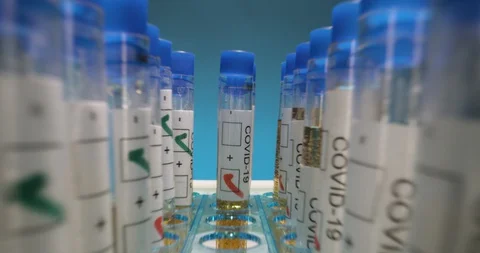 Move out from Vials of testing for COVID-19 in laboratory Stock Footage 127676641
