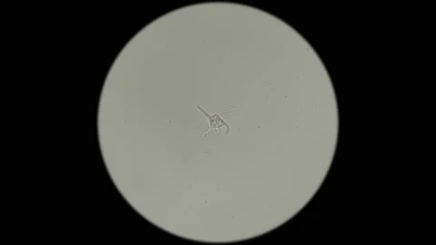 The movement of an amoeba-a parasite under a microscope 動画素材 85627310