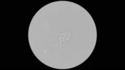 The movement of an amoeba-a parasite under a microscope Stock Footage 85628310