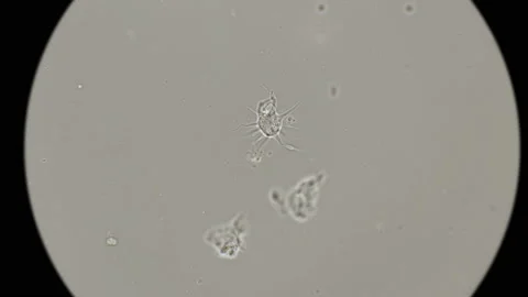 The movement of an amoeba-a parasite under a microscope 動画素材 88390827