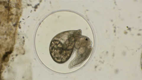 The movement of the formed cochlea embryo in which one can clearly see how the Video stock 94723337