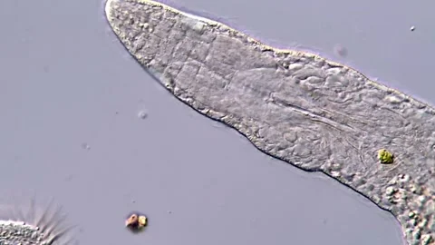 Movement of freshwater microorganism under microscope, 400x 库存影片 317210633