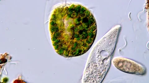Movement of Green protozoa under microscope, euplotes ciliate 動画素材 317885107