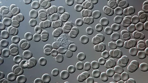 Movement of Human Red and White blood cells under microscope 库存影片 306588612