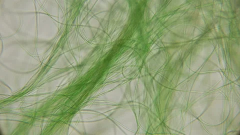 Movement of live algae under a microscope, similar to the tentacles of the body Stock Footage 90237224