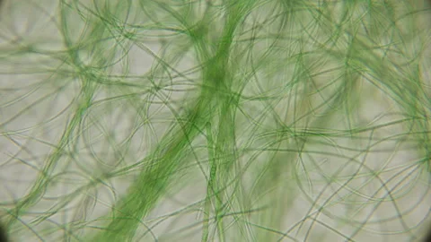 Movement of live algae under a microscope, similar to the tentacles of the body Stock Footage 90237324