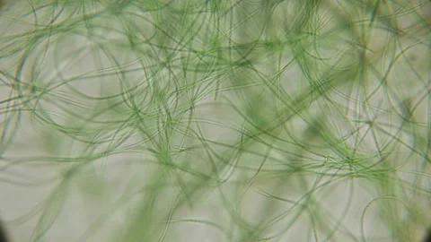 Movement of live algae under a microscope, similar to the tentacles of the body Stock Footage 90237798