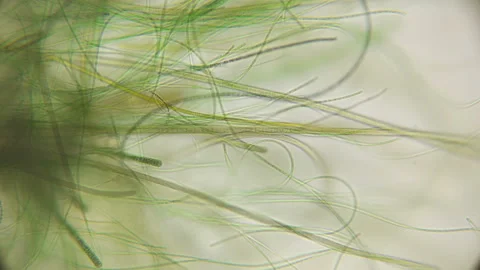 Movement of live algae under a microscope, similar to the tentacles of the body Stock Footage 90238120