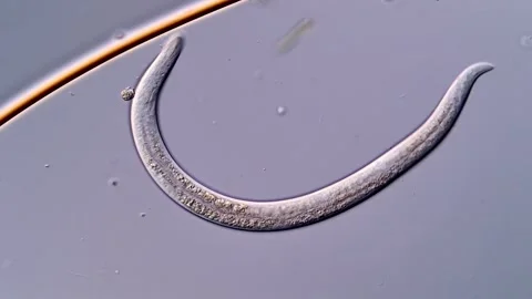Movement of Nematodes Parasite under microscopy view 400x Vídeos de archivo 310386658