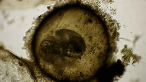 Movement of the snail embryo in the egg, under a microscope Stock Footage 92706825