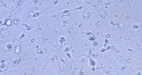 Movement of spermatozoa under a microscope Stock Footage 88427978