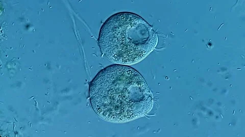Movement of Vorticella under microscopy view 스톡 동영상 306588032