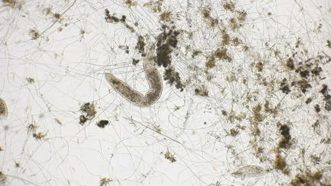 Movement of the worm oligochaet under the microscope Stock Footage 90368450