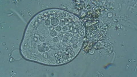 Movements of a vorticella seen with an optical microscope, water of pond sample Stock Footage 106994374