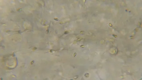 Moving Human Sperm Under Phase Contrast Microscope. Sperm (Spermatozoa) Viewe Stock Footage 123991817