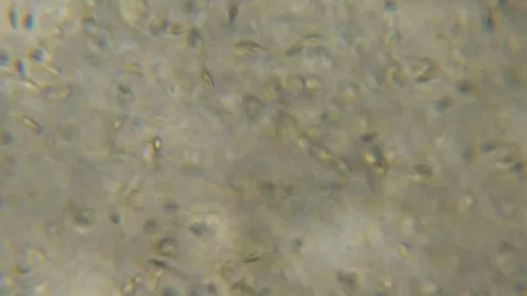 Moving Human Sperm Under Phase Contrast Microscope. Sperm (Spermatozoa) Viewe Stock Footage 123991842