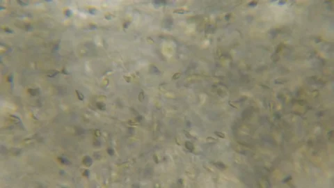 Moving Human Sperm Under Phase Contrast Microscope. Sperm (Spermatozoa) Viewe Stock Footage 128277798