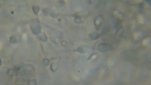 Moving Human Sperm Under Phase Contrast Microscope. Sperm (Spermatozoa) Viewe Stock Footage 136567204