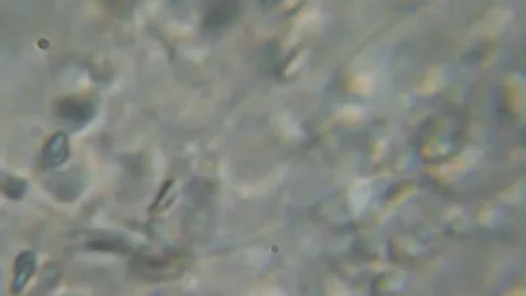 Moving Human Sperm Under Phase Contrast Microscope. Sperm (Spermatozoa) Viewe Stock Footage 138806255