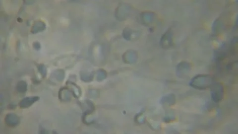 Moving Human Sperm Under Phase Contrast Microscope. Sperm (Spermatozoa) Viewe Stock Footage 157039857